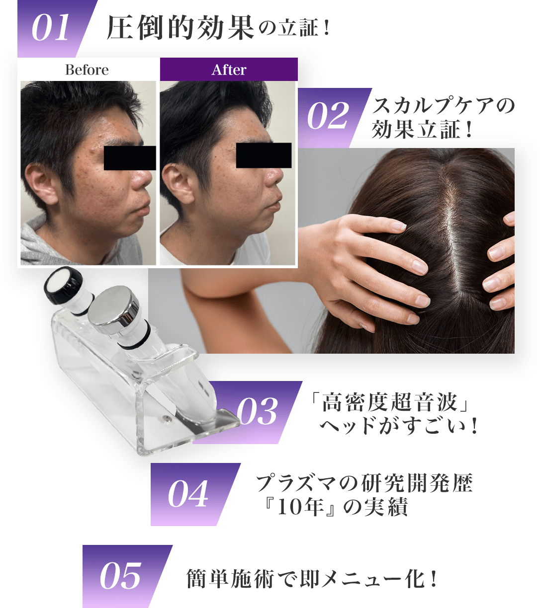 不安を解消する５つの理由