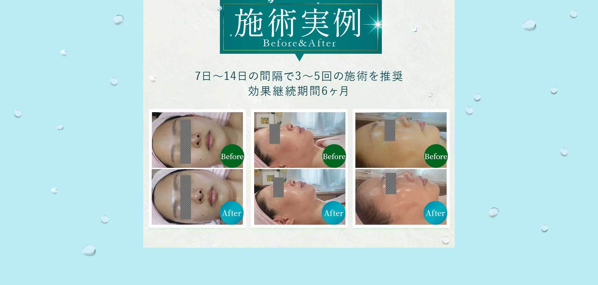 施術例